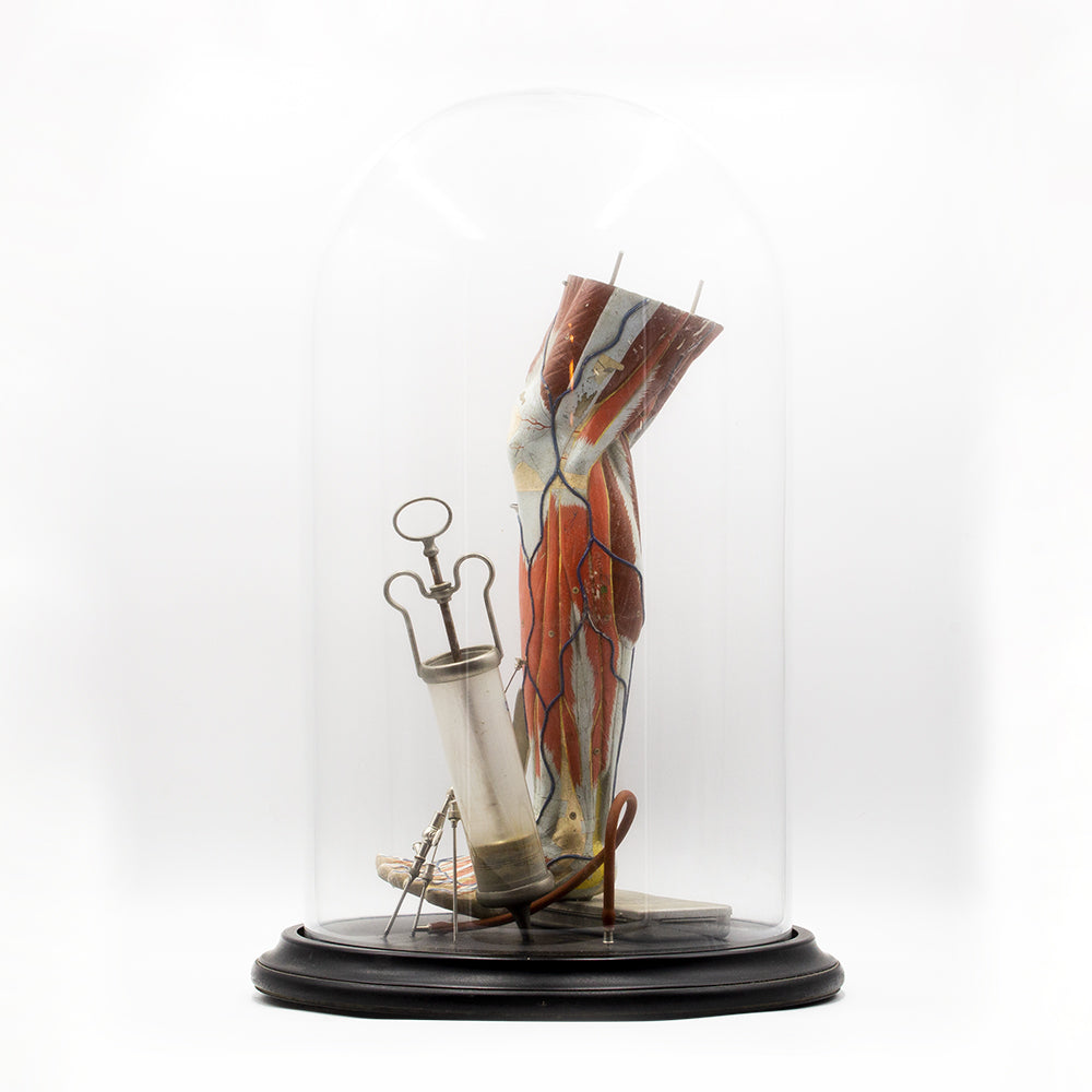 Glass dome displaying medical model of leg and orginal medical instuments